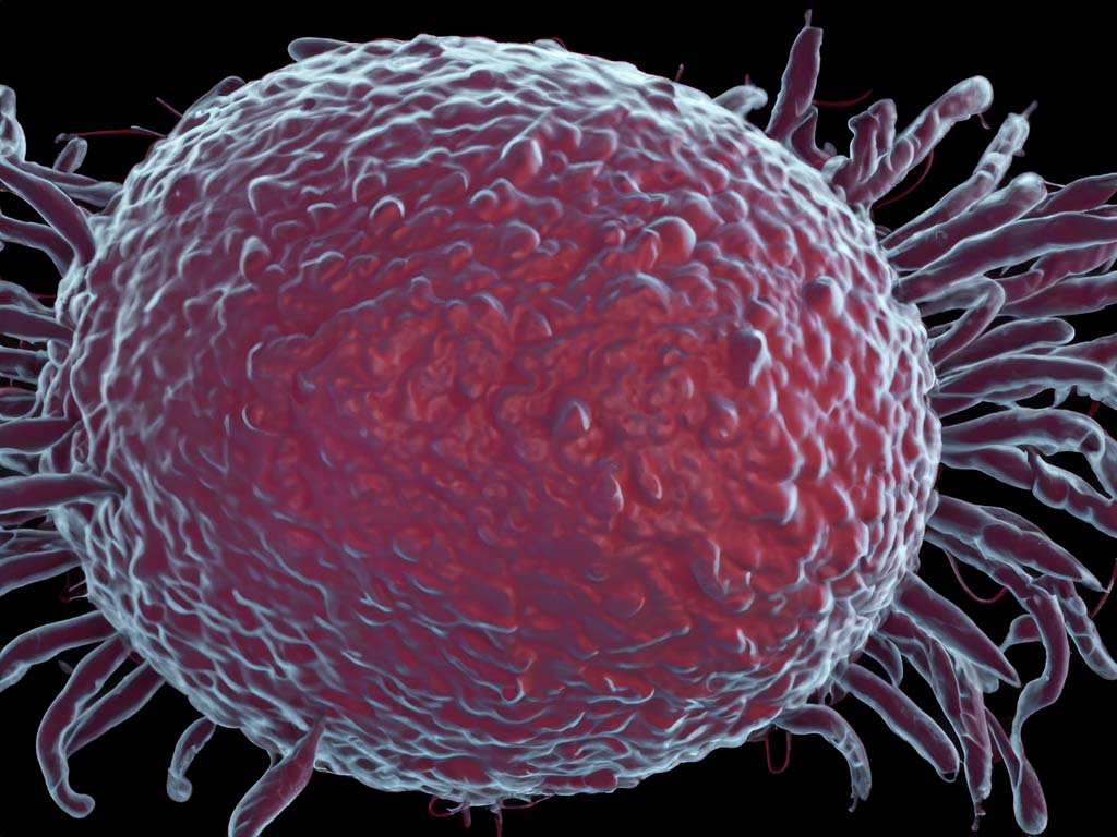 Mikroskopische Ansicht des Helicobacter pylori-Bakteriums im Magengewebe